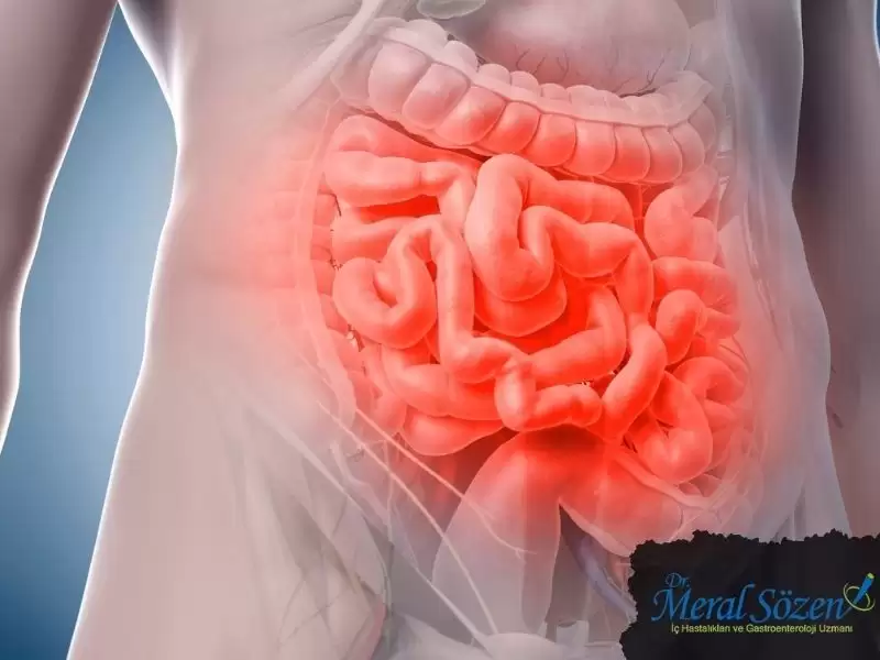 duodenum-ulseri-tedavisi-ankara