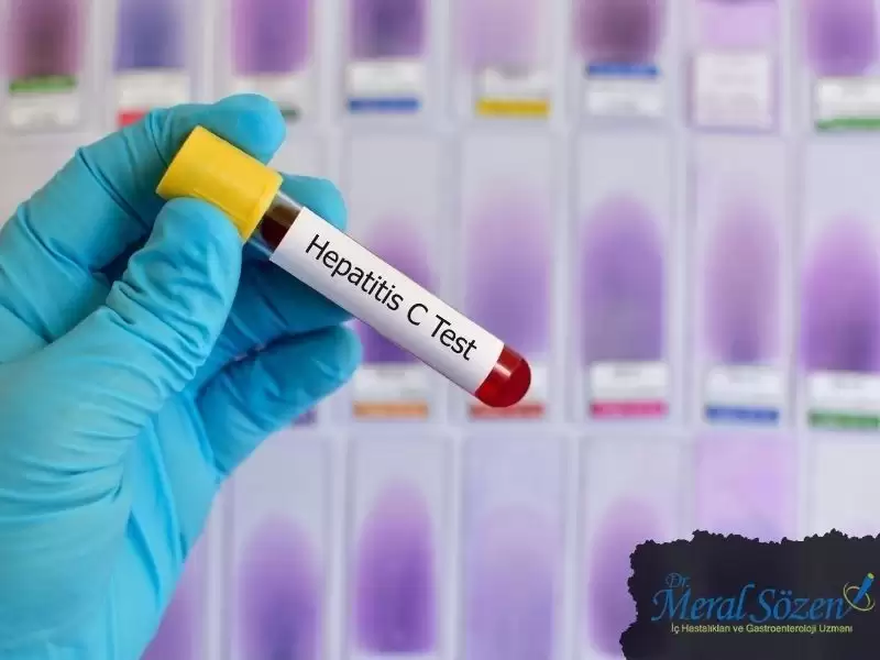 hepatit-c-nedir