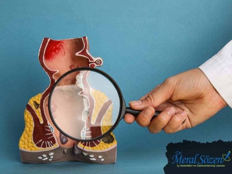 anotektal-manometre-nasil-uygulanir