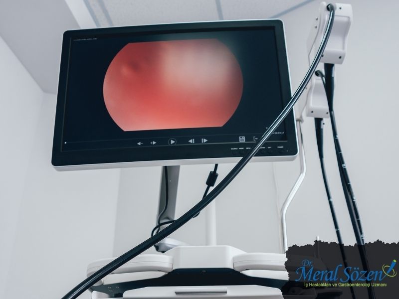 endoskopi-neden-yapilir