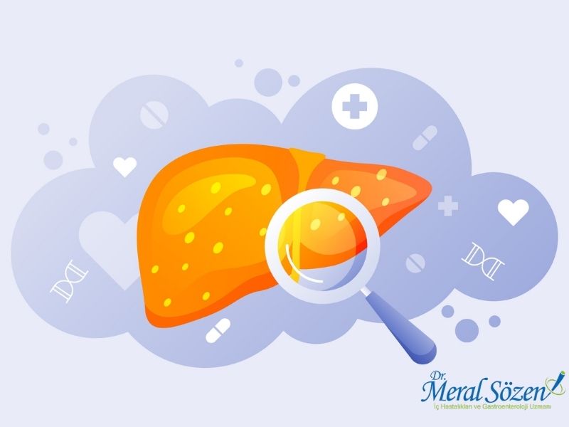 /karaciger-kanseri-risk-faktorleri