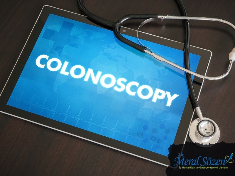 kolon-kanseri-tespit-yontemleri