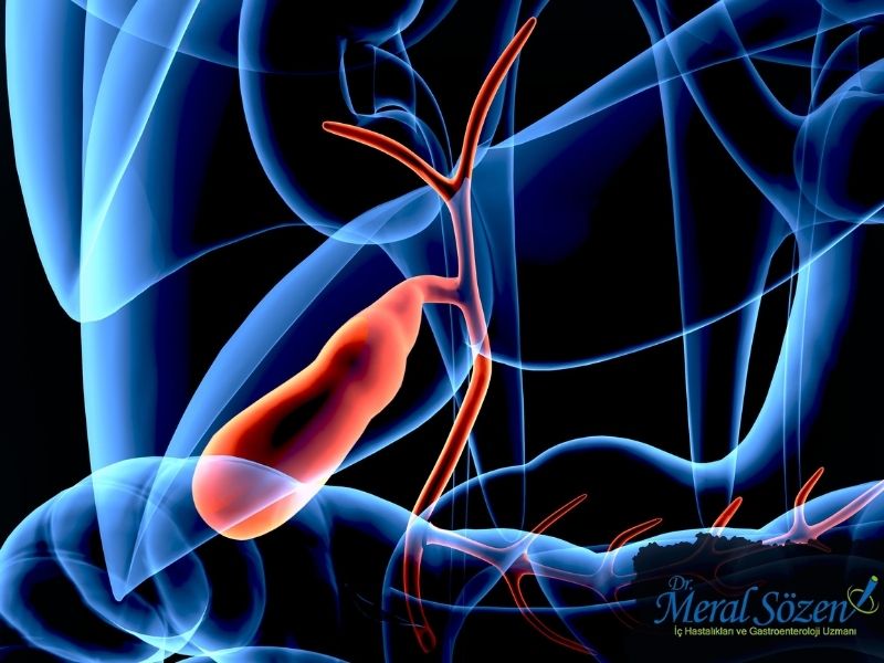 safra-kesesi-iltihabi-neden-olur