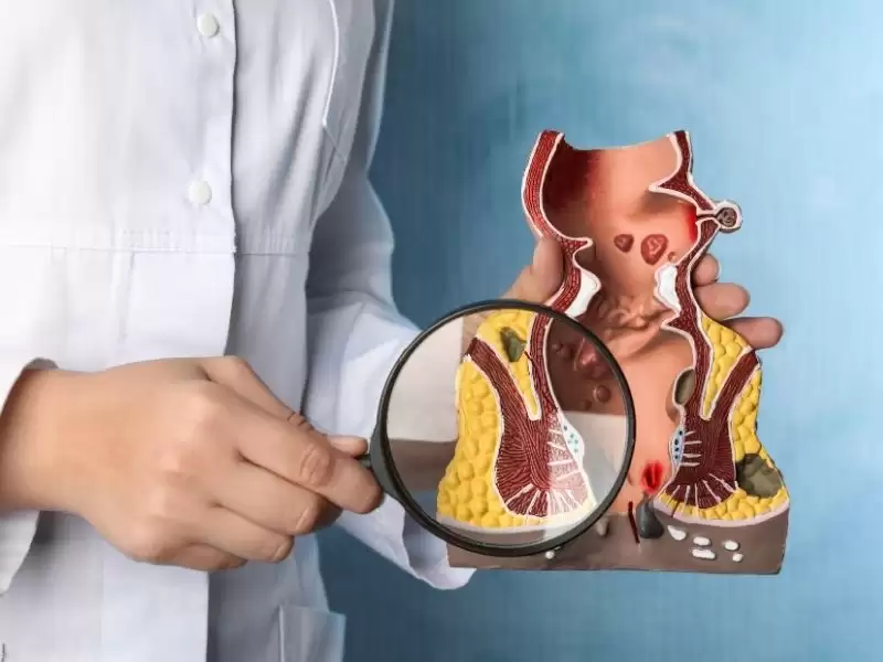 kolonoskopi-oncesi-beslenme