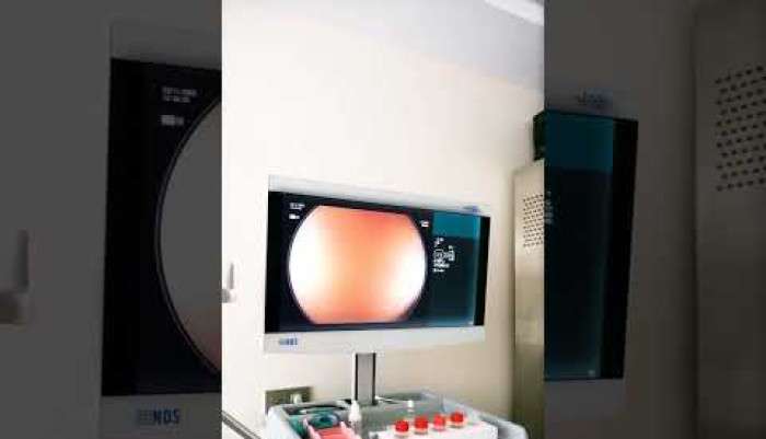 video,paylaşım,kameralı telefon,videofon,ücretsiz,yükleme