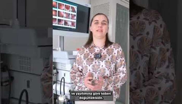 video,paylaşım,kameralı telefon,videofon,ücretsiz,yükleme