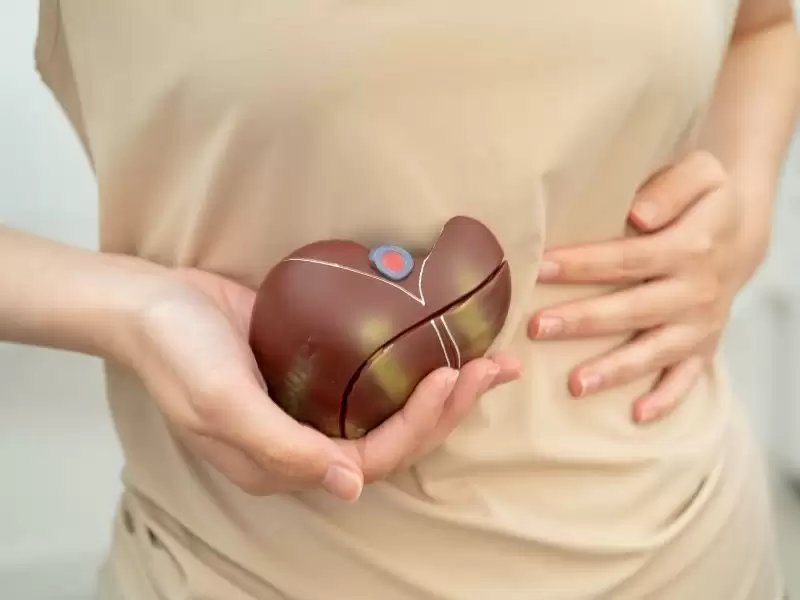 karaciger-yaglanmasi-tedavisi